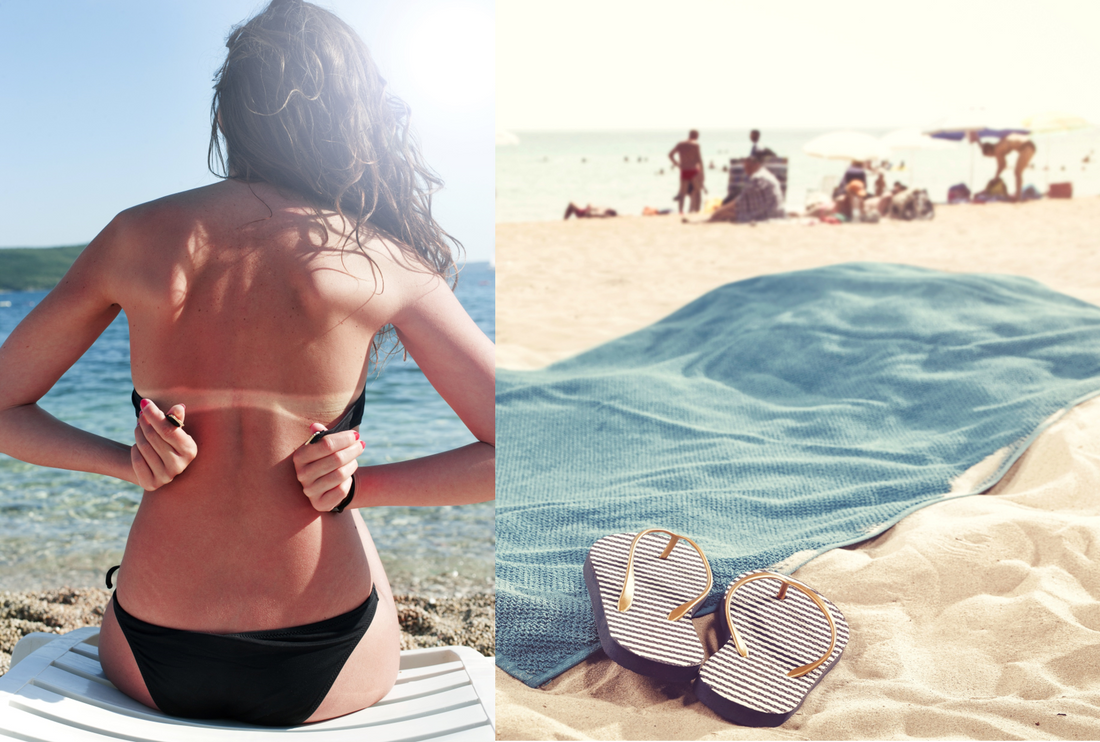 Quoi faire pour soulager et traiter les coups de soleil?